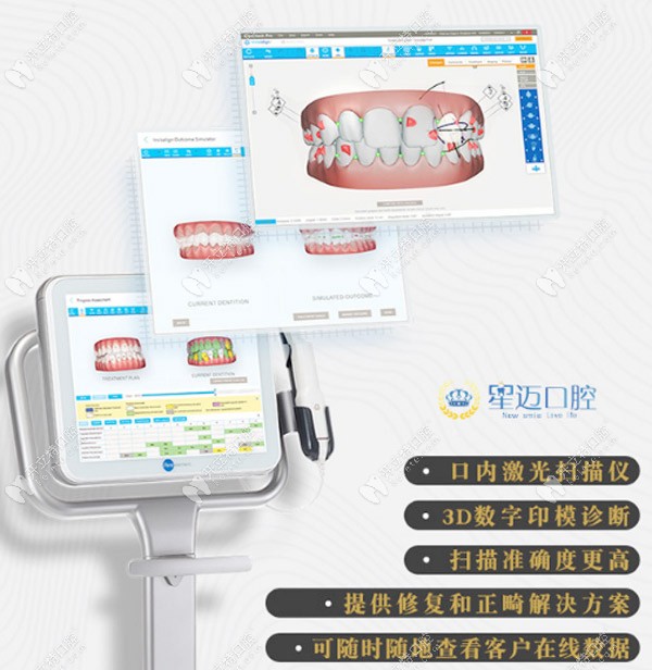 iTero口掃設(shè)備的特點