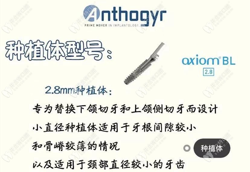 法國(guó)安卓健植體