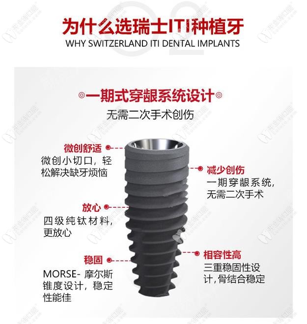 瑞士iti士卓曼種植體好嗎？