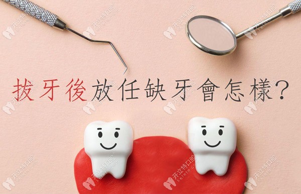 4K+就能做韓國奧齒泰種植牙,這次德韓連鎖口腔有話說