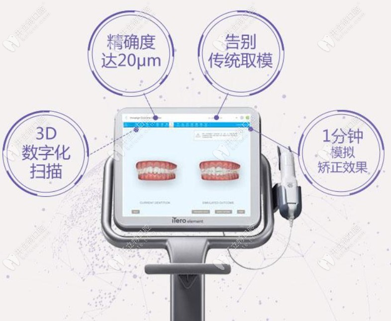 廣大口腔iTero口掃設(shè)備特點