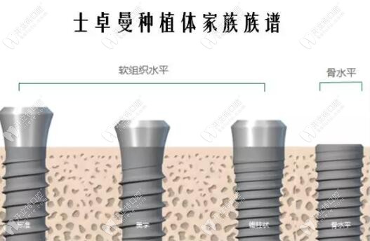 別只看價(jià)格,士卓曼種植體材料鈦鋯和純鈦區(qū)別不是一點(diǎn)點(diǎn)