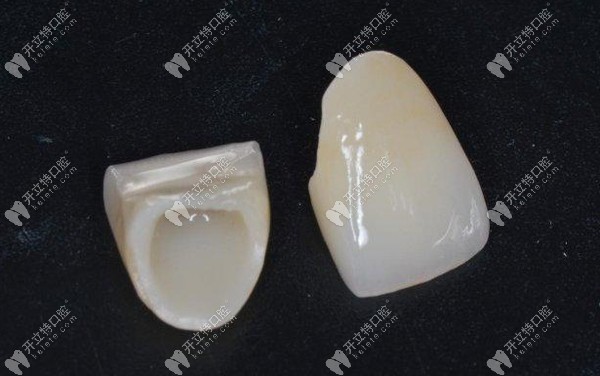 洋紫荊紫晶全瓷牙質(zhì)量怎么樣