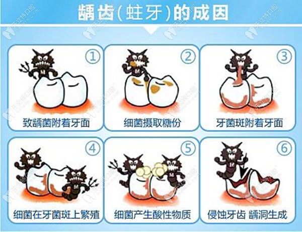 跪求廈門(mén)補(bǔ)牙哪家醫(yī)院好，補(bǔ)蛀牙一般多少錢(qián)一顆