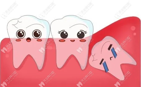 玉林藍(lán)天口腔拔智齒怎么收費(fèi)?友友們較關(guān)心的價格表來啦!