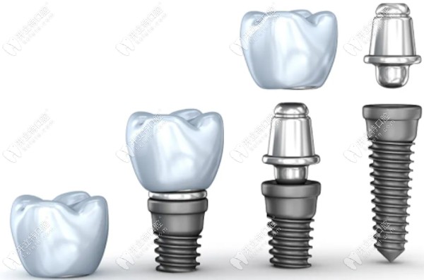 瑞士ITI較意大利BB價(jià)格高