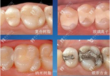 不同樹脂材料類型及價格