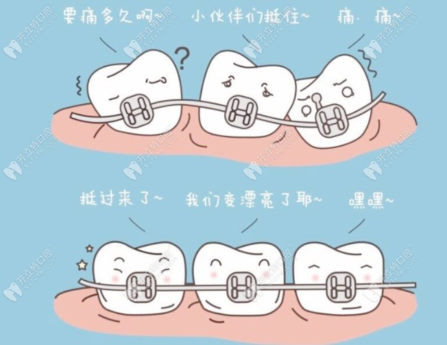 矯正的階段可能有點(diǎn)疼