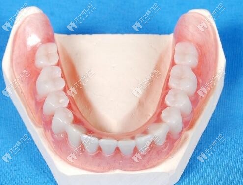 活動義齒展示圖 活動義齒展示圖