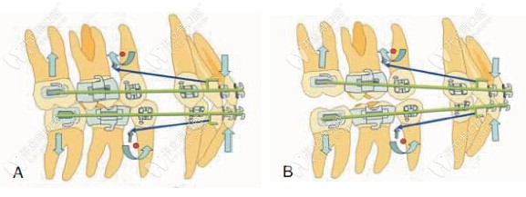 傳動矯正技術(shù)原理