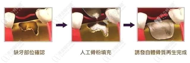 國(guó)產(chǎn)骨粉骨膜與進(jìn)口的骨粉價(jià)格