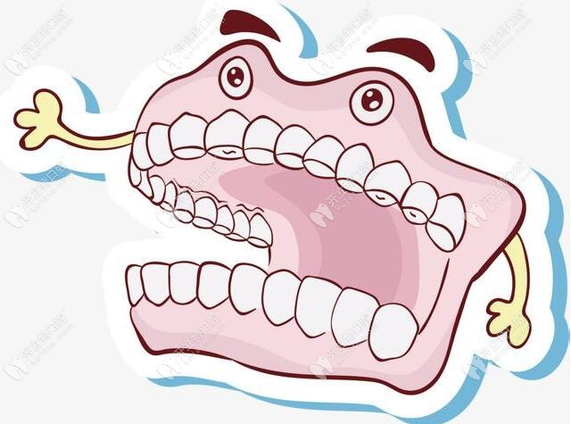 兒童要佩戴活動義齒修復(fù)