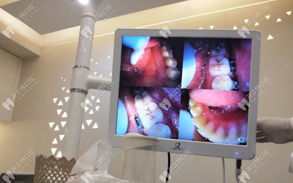 重慶美奧口腔種植牙設(shè)備