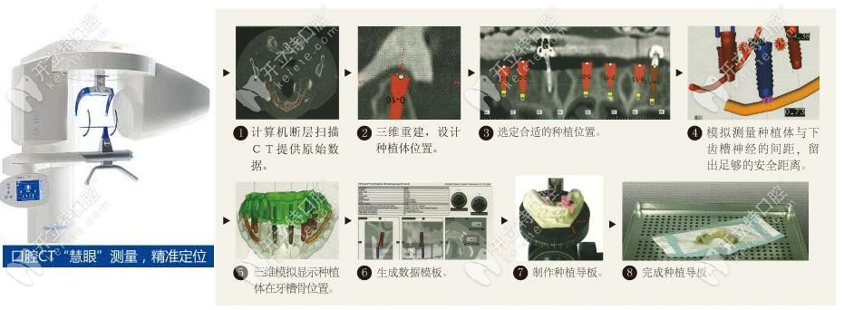 <!--<i data=20240703-sp></i>-->口腔種植牙技術(shù)