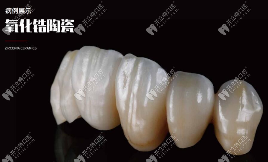 愛爾創(chuàng)全瓷牙冠美學(xué)修復(fù) 愛爾創(chuàng)全瓷牙冠美學(xué)修復(fù)