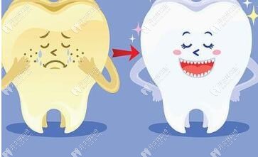 美國達(dá)妃琦牙齒美白怎么樣,和皓齒及冷光美白相比有啥區(qū)別