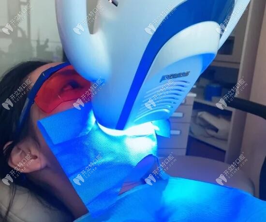 美國達妃琦牙齒美白